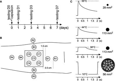 Capsaicin-Induced Skin Desensitization Differentially Affects A-Delta and C-Fiber-Mediated Heat Sensitivity